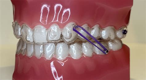 Ortho.