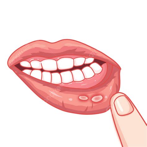 oral.